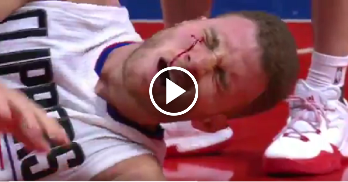Blake Griffin Receives Stitches After Getting Eye Busted Open By San Antonio Spurs