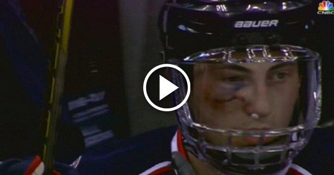 Blue Jackets' Zach Werenski Returns To Game After Taking Puck To The Face Like It's No Big Deal